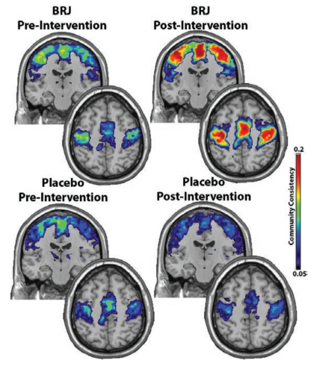 Активность головного мозга до(левая часть) и после(правая часть) эксперимента.